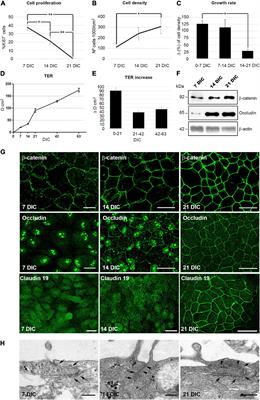 Key Role for CRB2 in the Maintenance of Apicobasal Polarity in Retinal Pigment Epithelial Cells